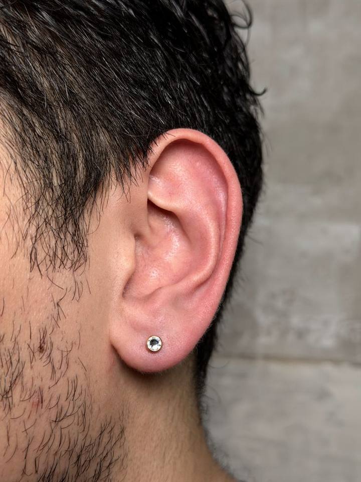 Example: lobe